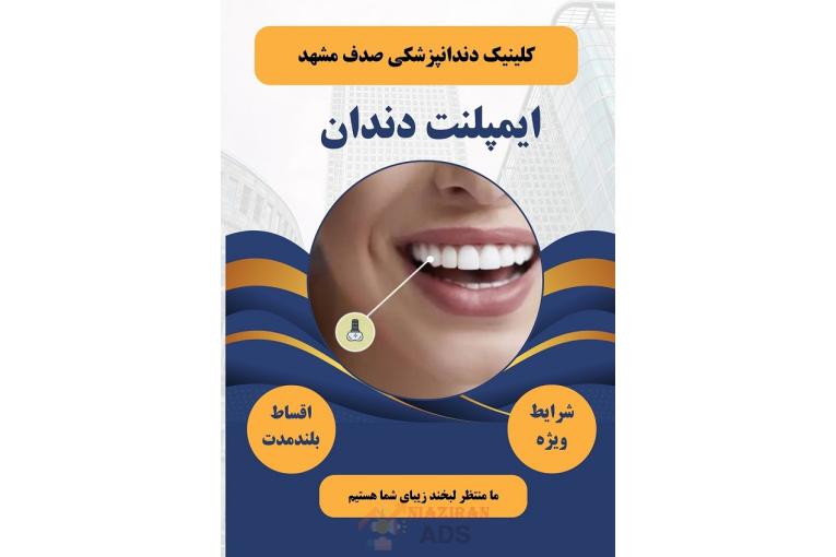 ایمپلنت دندان در مشهد با اقساط بلند مدت، بدون پیش پرداخت ( دیگه نگران هزینه‌ها نباش )